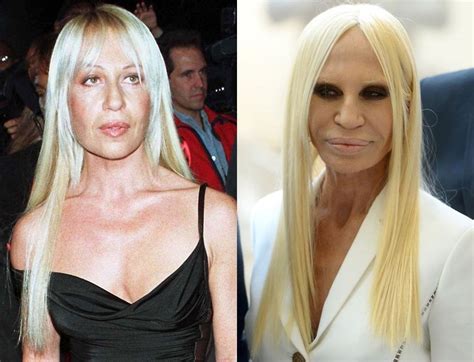 foto recenti donatella versace|donatella versace before and after surgery.